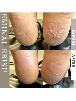 エミナル 恵比寿(EMINAL)/