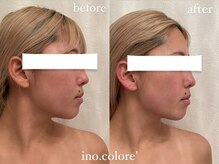 リノコロレ(ino.colore')/【人気No.1小顔コルギ】×1回