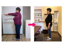 はやしだ鍼灸整骨院/3ヶ月でー12.6キロ！！