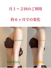 リリーフ(relief)/タップして拡大！