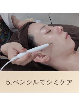 エクラ(eclat)/シベンシルシミケアでシミ部分に