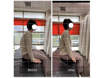 エモアメディカル整体院 麻布十番(Emoaメディカル整体院)/【30代女性】全身倦怠感・姿勢