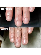 カラーネイルスタジオ(Callanail studio)/ケアだけでもスッキリな見た目に