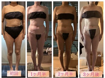 フェルーシュ 銀座店(Feruche)/セルラムの劇的変化