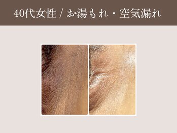 ラウン 京都(ROUN')/1回の施術のビフォーアフター