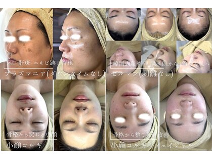 キュアリード(Cure_Lead)の写真