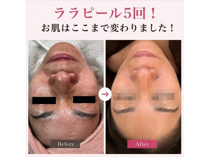 フェリームー(feerie mu)の写真