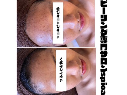 スピカ(spica)の写真