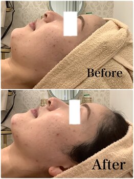 スペチアーレ 夙川/無制限ハイリフ×金糸×シャワー