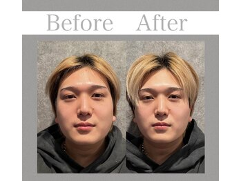 キクキク(KIKUKIKU)/ビフォーアフター