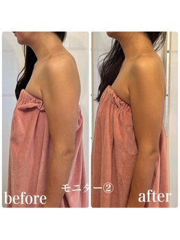 サチ(Sachi)/40代目前で下垂に気づいた