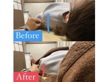 ナオル整体 宮崎院(NAORU整体)/20代女性施術事例【巻き肩調整】