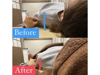 ナオル整体 宮崎院(NAORU整体)/20代女性施術事例【巻き肩調整】