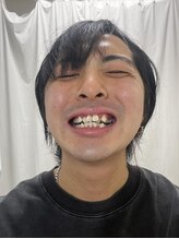 ライトビューティー 池袋店(LightBeauty)/ダコ地底　様ご来店☆