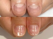 キラネイル アンド アイラッシュ by World Beauty(KIRA)/#自爪育成