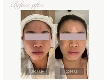 パルタージュ(Partage)/ハーブトリートメント