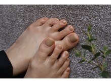 アルスカー(Alskar)/