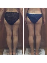 プリンセス バイ セイフティプリンセス 長野店(PRINCESS)/下半身痩せ特化メニュー