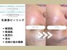【肌質改善】乳酸菌ピーリング≪肌荒れ・日焼け後の鎮静・赤み・敏感肌≫