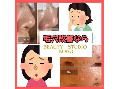 ココ(Koko)の写真