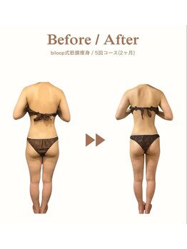 ビループ(biloop)/骨格から変えていく。