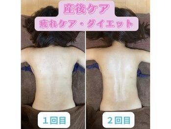 トータルボディケア サニー(TOTAL BODY CARE)/産後ケアで骨格矯正と疲労ケア