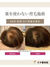 ビオ整体院 北 名古屋院/再生育毛促進術