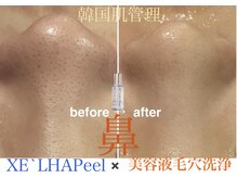 ロージースマイル(Rosy smile)の雰囲気(『セラピール』美容乳酸菌のチカラでくすみ・毛穴・キメ・透明感)