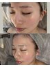 【赤み・ニキビ・ゆらぎ肌】韓国式肌管理でうるおいバリアケア 150分 ￥13,000