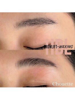 シュエット(Chouette)/ハリウッドブロウリフト