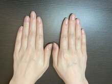 桃の木 吉祥寺店/手にもUVケアは必要です