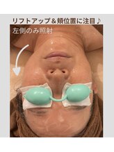 デザート(dessert)/BBL光フェイシャル