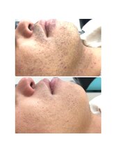 エリクサー 太田店(Elixir)/before after