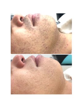 エリクサー 太田店(Elixir)/before after