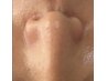 密かな人気部位【鼻毛ケア】病みつきになる人、続出中！！