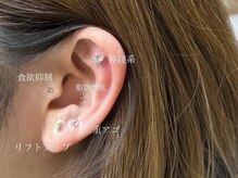 トータルビューティー ララ(Total Beauty RARA)/耳ツボジュエリー