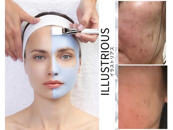 スイートルーム(Sweet Room)/美白・シミケアならこれ！