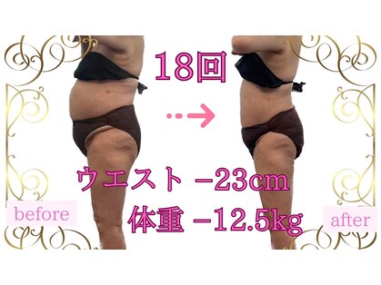 アンシャンテ(Enchante)の写真
