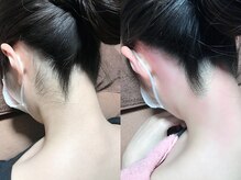 クラウン ジュエルズ(CROWN JEWELS)/【Wax脱毛】うなじ