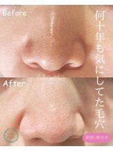 モエラビューティーサロン(Moela beauty salon)/【全顔毛穴洗浄×ハーブ】