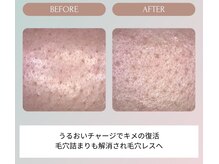 ノーブル(NOBLE)/ムートンホイップスパ大阪/野田