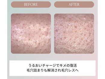 ノーブル(NOBLE)/ムートンホイップスパ大阪/野田