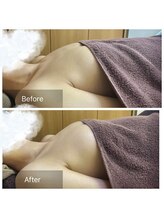 ノルン(Norn)/20代バストケア（6回目）