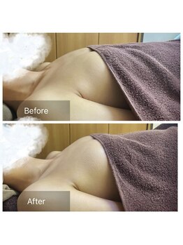 ノルン(Norn)/20代バストケア（6回目）