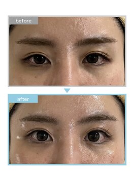 アジーク(AGEQUE)/眼精疲労もお任せください♪