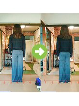 サプライズ整体院/30代ママさんの産後の骨盤初回