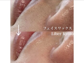 エステティック リベル キョウト 京都駅前店(Esthetic Liber Kyoto)/フェイスワックス脱毛