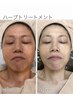【人気のエイジングケア♪】幹細胞ハーブ2g+整顔+デコルテ(total110分)22000