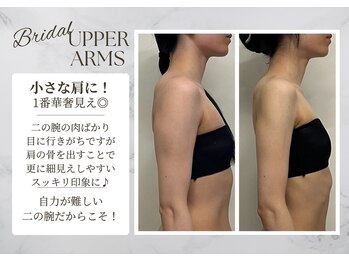 サロンドエリ ラクロワジエール(Salon d’ERI la Croisiere)の写真/なかなか減らない二の腕、諦めないで！花嫁姿を美しく飾るブライダルエステ◎