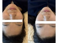 サロンミニー(salon’Minnie)の雰囲気（脱毛は結果が全て！結果にこだわルサロンです！満足度◎ VIO脱毛）